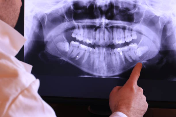 Best Emergency Treatment for Dental Infections or Abscesses in Stateburg, SC