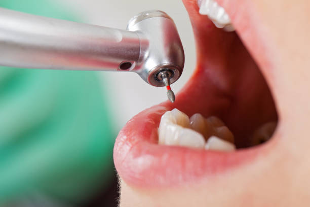Best Pediatric Emergency Dentist in Stateburg, SC